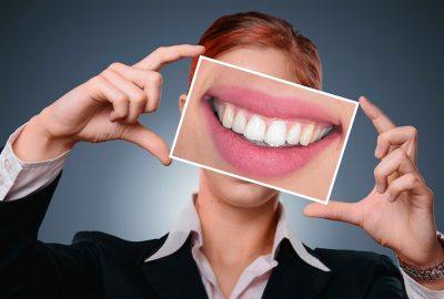 Percantik Senyum Anda dengan Veneer Gigi: Solusi Terbaik untuk Tampil Lebih Percaya Diri