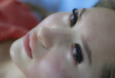 Tips Mengatasi Jerawat dengan Cara Alami yang Terbukti Efektif